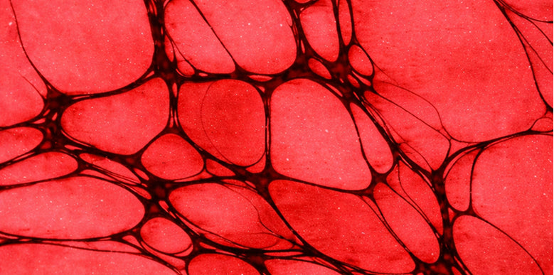 Inflammation and Pain: Why It Hurts and How to Calm It